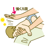 イラスト：背部叩打法　強く5回